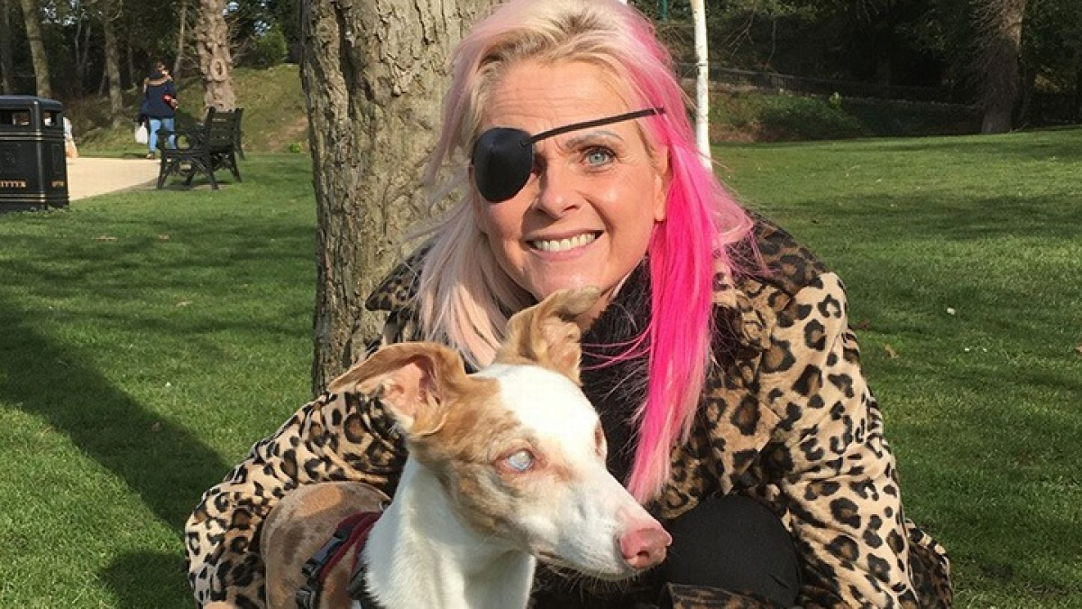 Une femme qui venait de perdre un œil doit son salut à son chien de sauvetage lui-même aveugle qui lui prouve que la cécité est surmontable